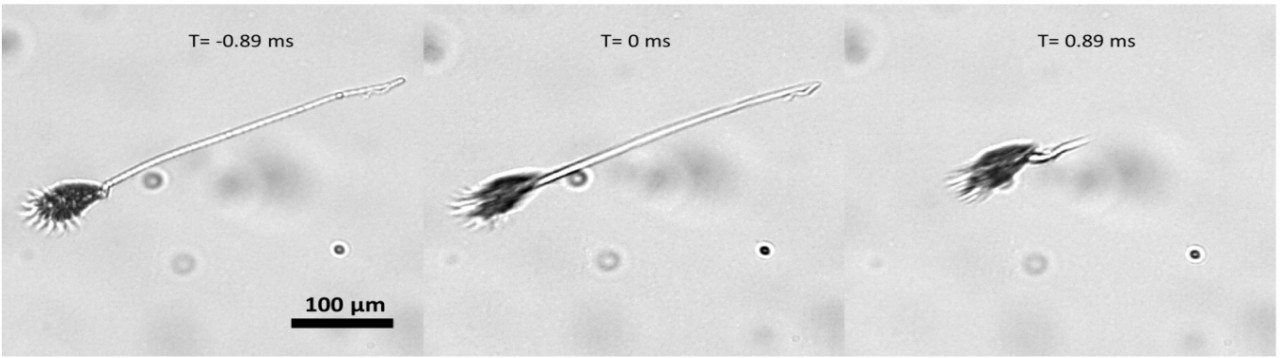 A tale of the ciliate tail